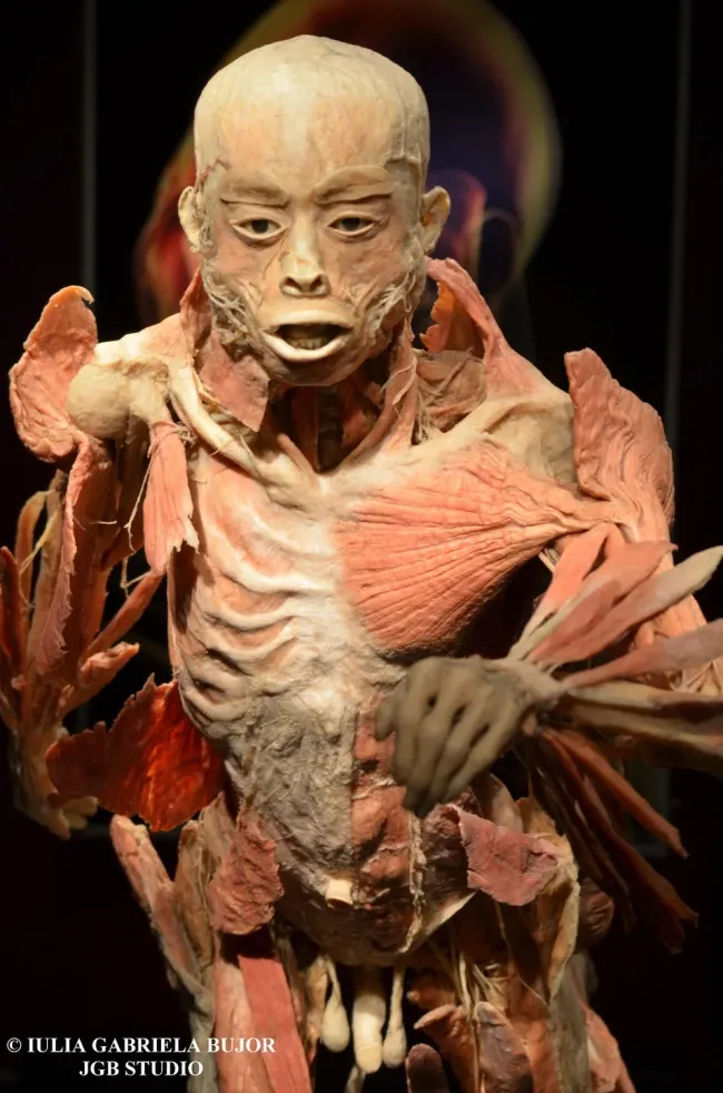 Урок анатомии, 